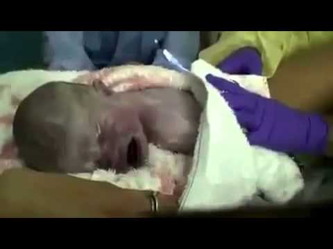 Live Childbirth Video home chlid delevry by midwife and pregnancy in water